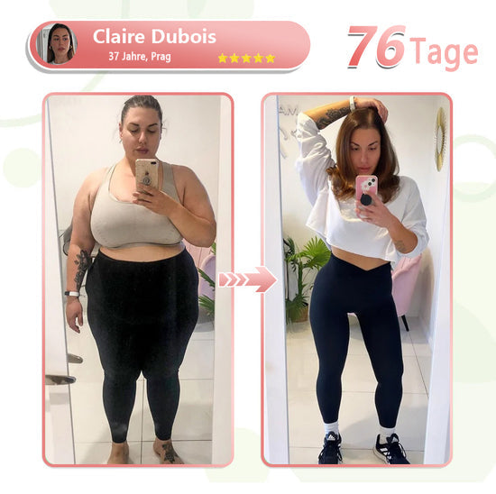 Berberine Slimming Patch Solaroza ®: Erhalten Sie die Kontrolle über Ihren Appetit, erhöhen Sie die Energie und reduzieren Sie natürlich den Stress. Mit anderen Worten, es ist dasselbe.