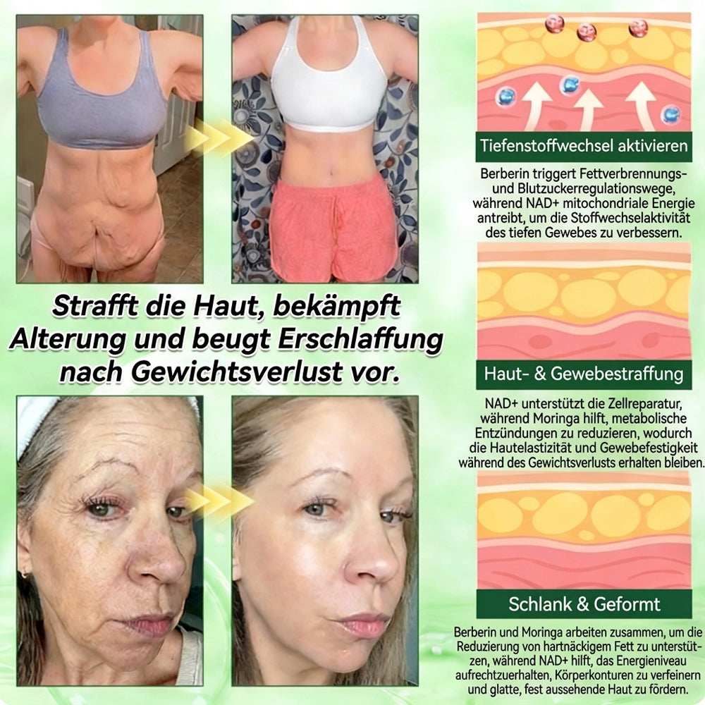 Offizieller Shop | ❤️❤️ Healrize® Moringa Berberinex NAD+ 10-in-1 Nano-Mikronadel-Patch (Nur einmal täglich, sichtbare Veränderungen in 7 Tagen) ✅ Für Übergewicht, lockere Haut, Diabetes, Schlafapnoe, Gelenkprobleme und mehr