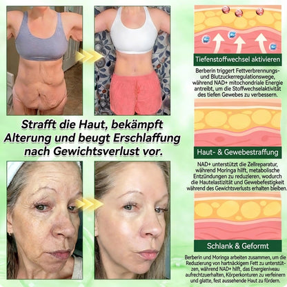 Offizieller Shop | ❤️❤️ Healrize® Moringa Berberinex NAD+ 10-in-1 Nano-Mikronadel-Patch (Nur einmal täglich, sichtbare Veränderungen in 7 Tagen) ✅ Für Übergewicht, lockere Haut, Diabetes, Schlafapnoe, Gelenkprobleme und mehr