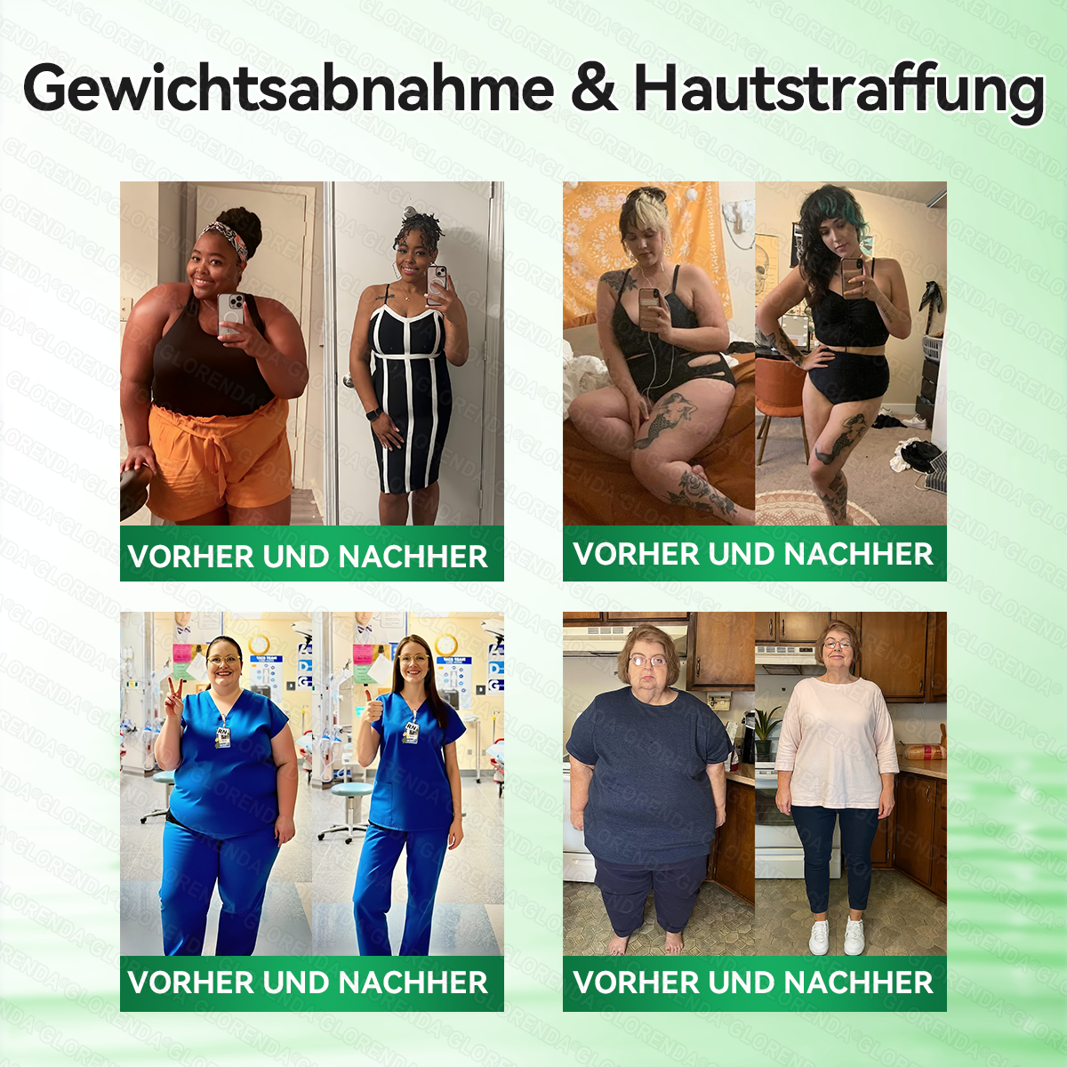 🇩🇪𝐎𝐟𝐟𝐢𝐳𝐢𝐞𝐥𝐥𝐞𝐫 𝐒𝐡𝐨𝐩 | 🩹👩‍⚕️ 𝑮𝑳𝑶𝐑𝐄𝐍𝐃𝘼® Moringa Berberinex NAD+ 10-in-1 Nano-Mikronadel-Patch (Nur einmal täglich, sichtbare Veränderungen in 7 Tagen) ✅ Für Übergewicht, lockere Haut, Diabetes, Schlafapnoe, Gelenkprobleme und mehr
