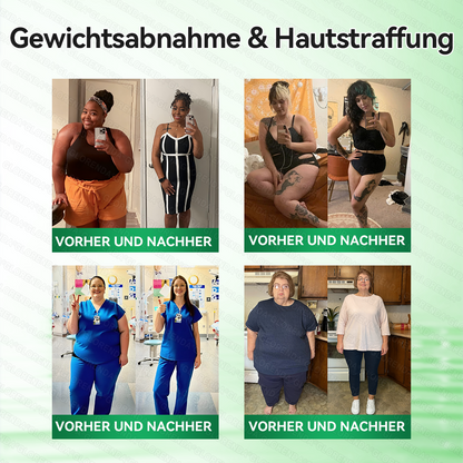 🇩🇪𝐎𝐟𝐟𝐢𝐳𝐢𝐞𝐥𝐥𝐞𝐫 𝐒𝐡𝐨𝐩 | 🩹👩‍⚕️ 𝑮𝑳𝑶𝐑𝐄𝐍𝐃𝘼® Moringa Berberinex NAD+ 10-in-1 Nano-Mikronadel-Patch (Nur einmal täglich, sichtbare Veränderungen in 7 Tagen) ✅ Für Übergewicht, lockere Haut, Diabetes, Schlafapnoe, Gelenkprobleme und mehr