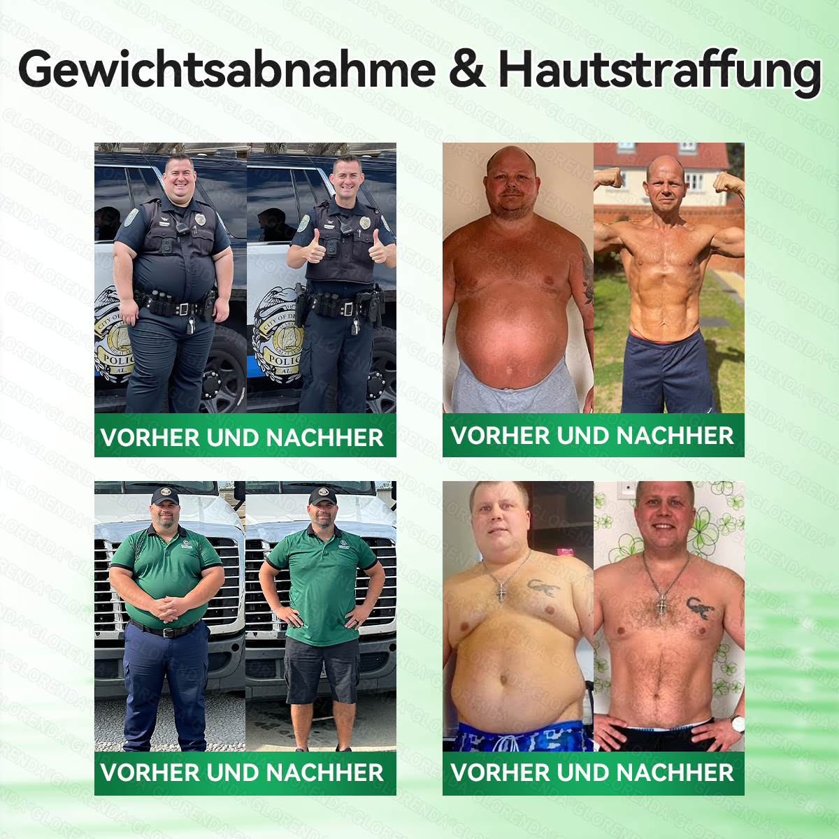 🇩🇪𝐎𝐟𝐟𝐢𝐳𝐢𝐞𝐥𝐥𝐞𝐫 𝐒𝐡𝐨𝐩 | 🩹👩‍⚕️ 𝑮𝑳𝑶𝐑𝐄𝐍𝐃𝘼® Moringa Berberinex NAD+ 10-in-1 Nano-Mikronadel-Patch (Nur einmal täglich, sichtbare Veränderungen in 7 Tagen) ✅ Für Übergewicht, lockere Haut, Diabetes, Schlafapnoe, Gelenkprobleme und mehr