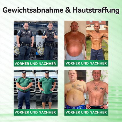🇩🇪𝐎𝐟𝐟𝐢𝐳𝐢𝐞𝐥𝐥𝐞𝐫 𝐒𝐡𝐨𝐩 | 🩹👩‍⚕️ 𝑮𝑳𝑶𝐑𝐄𝐍𝐃𝘼® Moringa Berberinex NAD+ 10-in-1 Nano-Mikronadel-Patch (Nur einmal täglich, sichtbare Veränderungen in 7 Tagen) ✅ Für Übergewicht, lockere Haut, Diabetes, Schlafapnoe, Gelenkprobleme und mehr