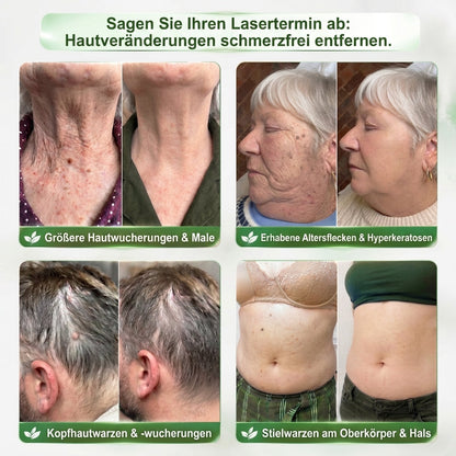 InnoMedix® 🧬𝑷𝑫𝑹𝑵 𝑨𝒏𝒕𝒊-𝑨𝒈𝒊𝒏𝒈 & 𝒈𝒆𝒛𝒊𝒆𝒍𝒕𝒆𝒓 𝑯𝒂𝒖𝒕𝒆𝒓𝒏𝒆𝒖𝒆𝒓𝒖𝒏𝒈𝒔-𝑺𝒕𝒊𝒄𝒌（𝑯𝒊𝒍𝒇𝒕, 𝑭𝒂𝒍𝒕𝒆𝒏 𝒔𝒊𝒄𝒉𝒕𝒃𝒂𝒓 𝒛𝒖 𝒈𝒍ä𝒕𝒕𝒆𝒏, 𝒖𝒏𝒕𝒆𝒓𝒔𝒕ü𝒕𝒛𝒕 𝒆𝒊𝒏 𝒔𝒕𝒓𝒂𝒇𝒇𝒆𝒓 𝒘𝒊𝒓𝒌𝒆𝒏𝒅𝒆𝒔 𝑯𝒂𝒖𝒕𝒃𝒊𝒍𝒅 𝒖𝒏𝒅 𝒗𝒆𝒓𝒃𝒆𝒔𝒔𝒆𝒓𝒕 𝒅𝒂𝒔 𝑬𝒓𝒔𝒄𝒉𝒆𝒊𝒏𝒖𝒏𝒈𝒔𝒃𝒊𝒍𝒅 𝒔𝒊𝒄𝒉𝒕𝒃𝒂𝒓𝒆𝒓 𝑯𝒂𝒖𝒕𝒇𝒍𝒆𝒄𝒌𝒆𝒏）