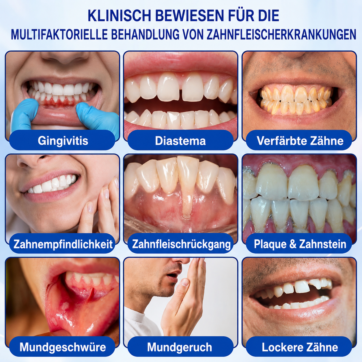[Noch 5 Minuten!] Healrize® GumRevive Gel zur Regeneration des Zahnhalteapparats