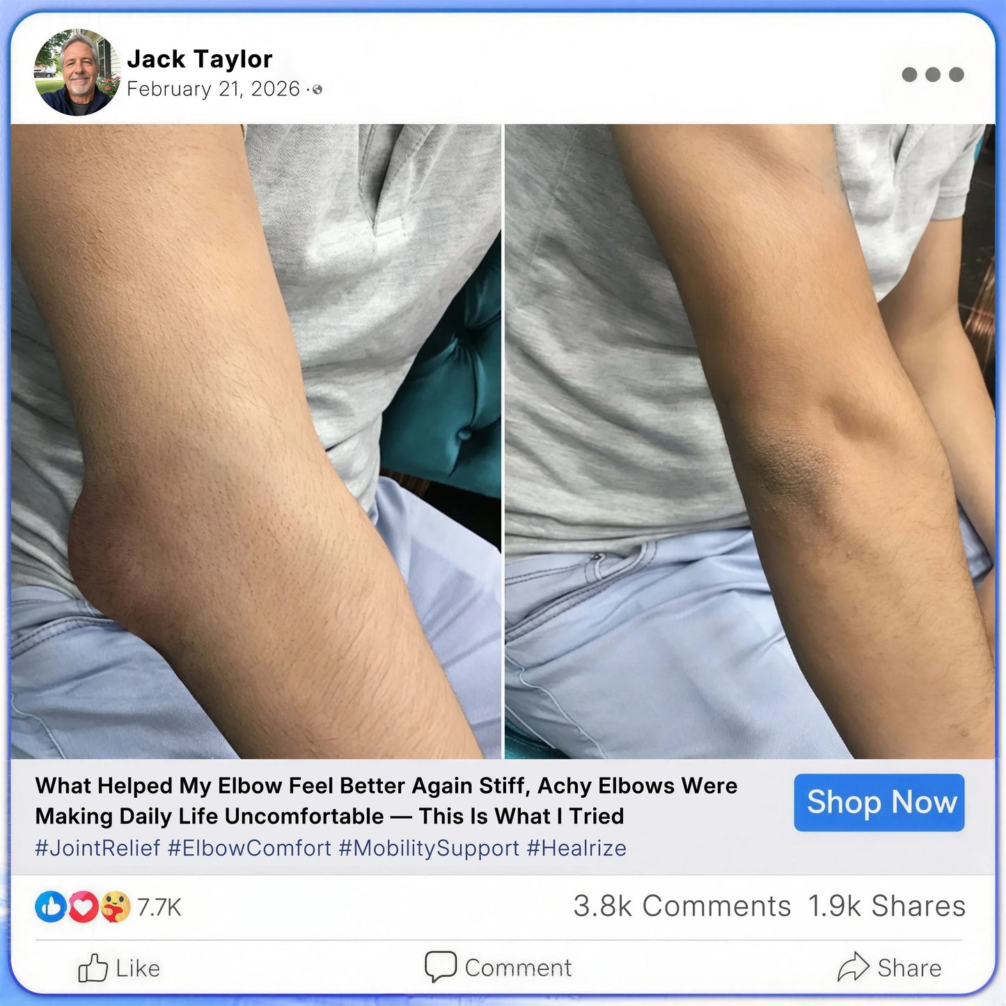 [Nur noch 5 Minuten!] Healrize® Bee Venom Joint Relief Cream 🦵Powerful Bee Venom Cream for Joint & Muscle Pain Relief – Feel Comfort in Minutes