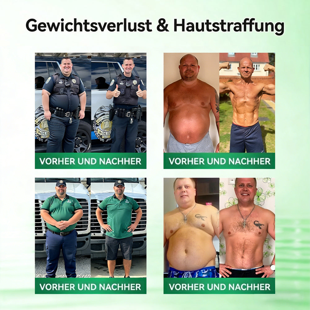 Offizieller Shop | ❤️❤️ Healrize® Moringa Berberinex NAD+ 10-in-1 Nano-Mikronadel-Patch (Nur einmal täglich, sichtbare Veränderungen in 7 Tagen) ✅ Für Übergewicht, lockere Haut, Diabetes, Schlafapnoe, Gelenkprobleme und mehr
