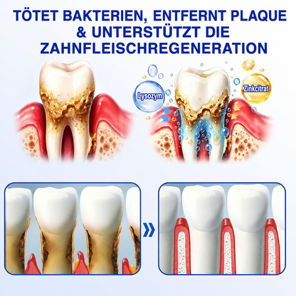 [Noch 5 Minuten!] Healrize® GumRevive Gel zur Regeneration des Zahnhalteapparats