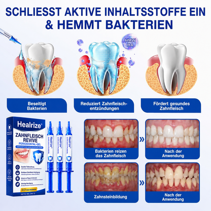[Noch 5 Minuten!] Healrize® GumRevive Gel zur Regeneration des Zahnhalteapparats